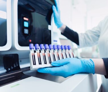 Connecticut Blood Center lab technician loading blood samples